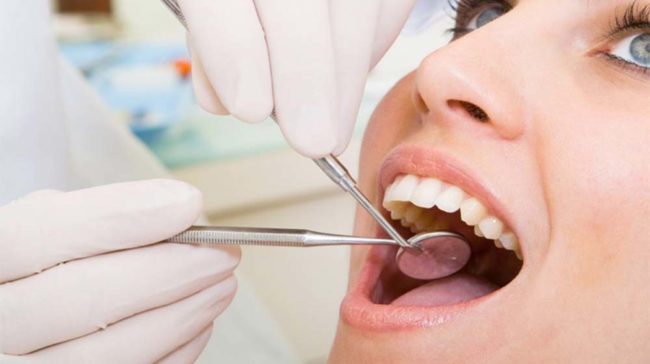 teeth polishing cost