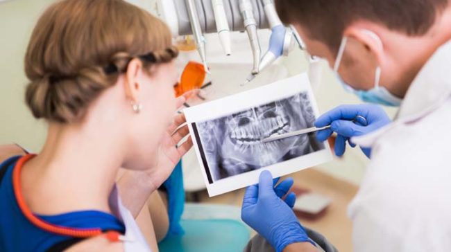 Top 5 Differences between Mini Dental Implants and Regular Dental Implants